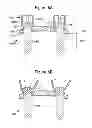 Fig. 11 - Orthopaedic plate