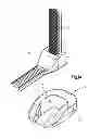 Fig. 02 - Caps for implants, implant assemblies, and methods of use