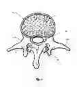 Fig. 02 - Pedicle screw