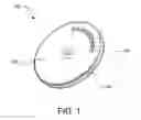 Fig. 02 - Implantable electroacupuncture system and method for reducing hypertension