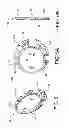 Fig. 08 - Radial feed through packaging for an implantable electroacupuncture device