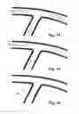 Fig. 07 - Stent system, deployment apparatus and method for bifurcated lesion