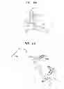 Fig. 09 - Method and device for heart valve repair