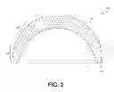 Fig. 03 - Self-centering, anti-seizing acetabular liner
