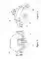 Fig. 07 - DEVICE FOR PROVIDING TACTILE FEEDBACK FOR ROBOTIC APPARATUS USING ACTUATION
