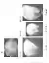 Fig. 35 - IDENTIFICATION AND USE OF EARLY EMBRYO AND/OR EARLY ENDOSPERM SPECIFIC PROMOTERS  FOR GENE EXPRESSION IN MAIZE