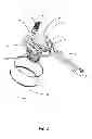 Fig. 09 - ASH VACUUM AND SEPARATOR WITH FILTER CLEANING DEVICE
