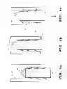 Fig. 07 - Feather imping pin