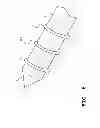 Fig. 09 - Feather imping pin