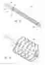 Fig. 09 - Bodily lumen occlusion