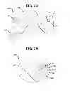Fig. 13 - Cleats, cleated sole structures, molds, and molding methods for in-molding articles