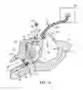 Fig. 02 - DEVICE FOR SURFACTANT ADMINISTRATION AND VENTILATION OF LOW BIRTH WEIGHT INFANTS