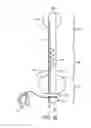 Fig. 07 - DEVICE FOR SURFACTANT ADMINISTRATION AND VENTILATION OF LOW BIRTH WEIGHT INFANTS