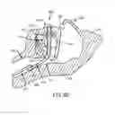 Fig. 09 - DEVICE FOR SURFACTANT ADMINISTRATION AND VENTILATION OF LOW BIRTH WEIGHT INFANTS