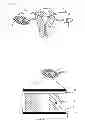 Fig. 02 - Fertility preservation device