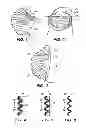 Fig. 02 - Pleated filtering face piece respirator