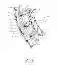 Fig. 04 - Transfer Ring Shoe and Transfer Ring Having Varied Shoe Profile