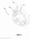 Fig. 05 - Abrasion resistant gas separator