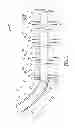Fig. 02 - Deploying an expandable downhole seat assembly