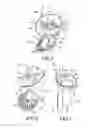 Fig. 06 - Wheel brake set for luggage case