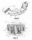 Fig. 08 - Cartridge shipping aid