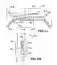 Fig. 06 - Microfluidic ultrasonic particle separators with engineered node locations and geometries