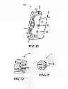 Fig. 06 - Dual cartridge filter stabilizer