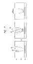 Fig. 07 - Plasma etching method
