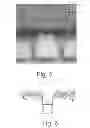Fig. 05 - Porous metal etching
