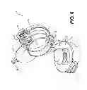 Fig. 07 - Sandwich making appliance and method of making a sandwich with the same