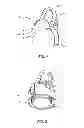 Fig. 02 - Dispensing closure assembly for a container