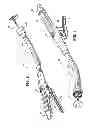 Fig. 02 - Ratcheting mechanism for surgical stapling device