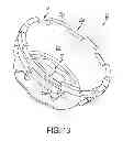 Fig. 21 - Pill crushing cup with rotational locking lugs