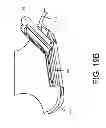 Fig. 150 - Encasements for an electronic device having a biometric scanner