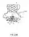 Fig. 178 - Encasements for an electronic device having a biometric scanner
