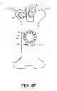 Fig. 31 - Encasements for an electronic device having a biometric scanner