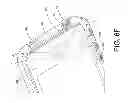 Fig. 45 - Housing for encasing an electronic device