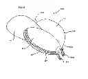 Fig. 49 - Lighted headgear and accessories therefor