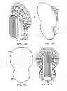 Fig. 41 - Agile duplexing wireless radio devices