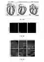 Fig. 02 - METHODS FOR INDUCING CARDIOMYOCYTE PROLIFERATION
