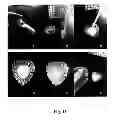 Fig. 08 - Composite hydrogel-clay particles