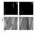 Fig. 06 - METHODS AND COMPOSITIONS FOR TREATMENT OF RETINAL DEGENERATION