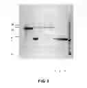 Fig. 03 - Suppression of prostate cancer using a targeted clostridial neurotoxin