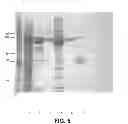 Fig. 06 - Suppression of prostate cancer using a targeted clostridial neurotoxin