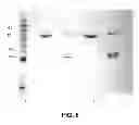 Fig. 07 - Suppression of prostate cancer using a targeted clostridial neurotoxin