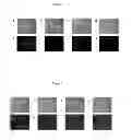 Fig. 02 - METHOD FOR THE DIAGNOSIS AND PROGNOSIS OF MALIGNANT DISEASES