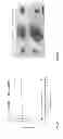 Fig. 04 - Administration of an Anti-Activin-A Compound to a Subject