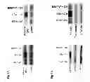 Fig. 06 - Administration of an Anti-Activin-A Compound to a Subject