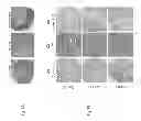 Fig. 08 - Administration of an Anti-Activin-A Compound to a Subject
