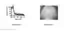 Fig. 02 - Serpinf2-binding molecules and method of use thereof